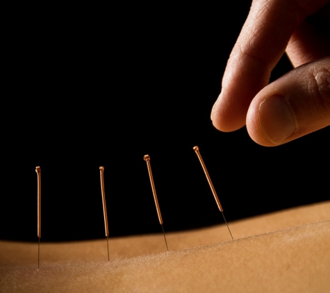 Cochise Acupuncture - Sierra Vista, AZ