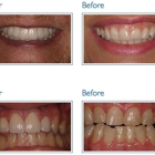 Gage Dental Care