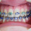 Santelli Orthodontics gallery