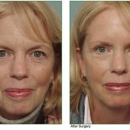 Allcroft Facial Plastic Surgery - Physicians & Surgeons, Cosmetic Surgery