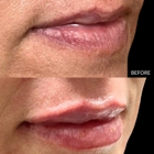 Beyond Esthetics Medspa