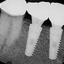 My Dentist Burbank - Prosthodontists & Denture Centers