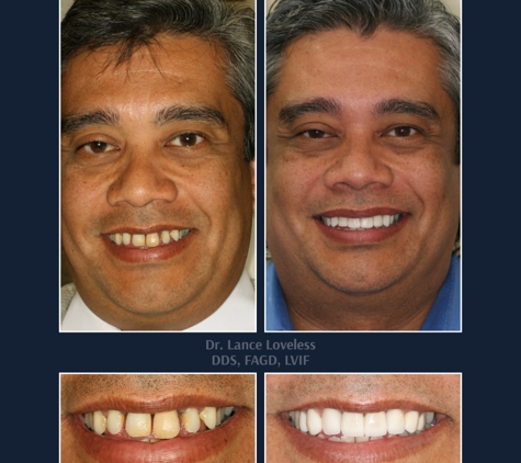 Bridgeview Dental - Austin, TX