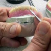 Tri-Star Denture gallery