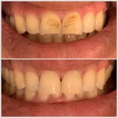 Rovel Dental by Dr. Ingrid R Romero - Dentists