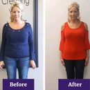 Bragg Weight Loss Knoxville - Weight Control Services