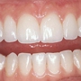 TLC For Gums - Gordon Wilson, DDS