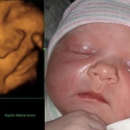 Jacksonville 4D Fetal Photo - Medical Imaging Services