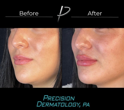 Precision Dermatology, PA - Kerrville, TX