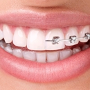 Full Smile Orthodontics - Orthodontists