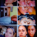 THE FACIAL COMPANY ACNE CLINIC - Medical Clinics