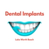 Dental Implants Lake Worth Beach gallery