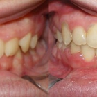 Allegany Orthodontics