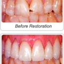 Greenwich Cosmetic Dentistry - Implant Dentistry
