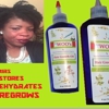 Lewoos hair growth oil gallery