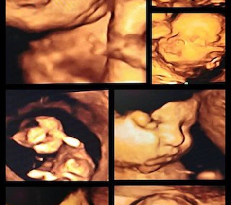 Baby Blessings 3D & 4D Ultrasound Studio - Danville, IL