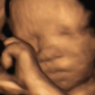 A New Conception 3D Ultrasound Studio - Hanover, MA. 36 weeks in 3D 4D ultrasound