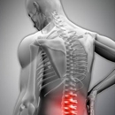 Musculoskeletal Health Centers - Health & Welfare Clinics