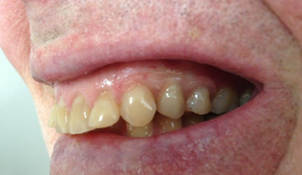 Dentures At Sorell - Sorell, TAS. Dentures At Sorell