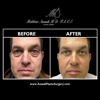 Asaadi Plastic Surgery gallery