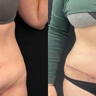 SR Plastic Surgery P.C.- Smita R. Ramanadham, M.D., F.A.C.S