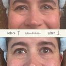 Achieve Esthetics - Day Spas