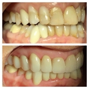 Pelican dental care - Cosmetic Dentistry