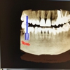 Saryan Dental gallery