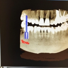 Saryan Dental