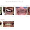 Advanced Dental Center - St. Matthews gallery