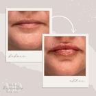 Wilkes Rejuvenation MD