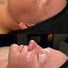 Ashley Skin Esthetics gallery