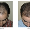 Liposuction and Cosmetic Surgery Institute gallery