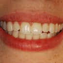 Prosthetic Dentistry of Washington DC - Cosmetic Dentistry