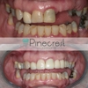 Pinecrest Family Dental gallery