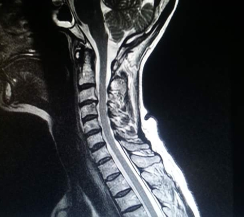 The Bonati Spine Institute - Hudson, FL. This is my cervical MRI....I hope that you can provide me with feedback on a poditive repair of my conditions. Arleta M Moles arlitamoles420