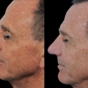 Facial Surgery Institute of Boca Raton gallery