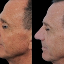 Facial Surgery Institute of Boca Raton - Physicians & Surgeons, Plastic & Reconstructive