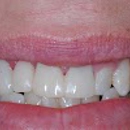 Love Dentistry - Dr. Sheri Boynton- Love - Cosmetic Dentistry