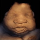 Belly 2 Birth 3D 4D Ultrasound - Medical Imaging Services