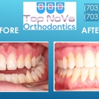 Top Nova Orthodontics