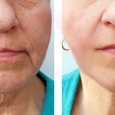 Beautox Bar LLC - Medical Spas