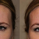 Dakota Plastic Surgery - Skin Care