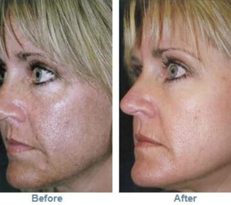 Hollywood Body Laser Center Colorado Springs - Colorado Springs, CO