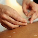 Benessere Miami Doral office - Acupuncture