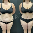 Chua Plastic Surgery - Physicians & Surgeons, Cosmetic Surgery