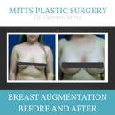 Mitts, Gordon M MD - Hair Removal