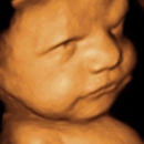 Picture Perfect 3D/4D Ultrasound Imaging - Family Planning Information Centers