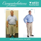 Medi-Weightloss Bristol