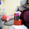 Memorial Sloan Kettering Cancer Center Blood Donation Room gallery
